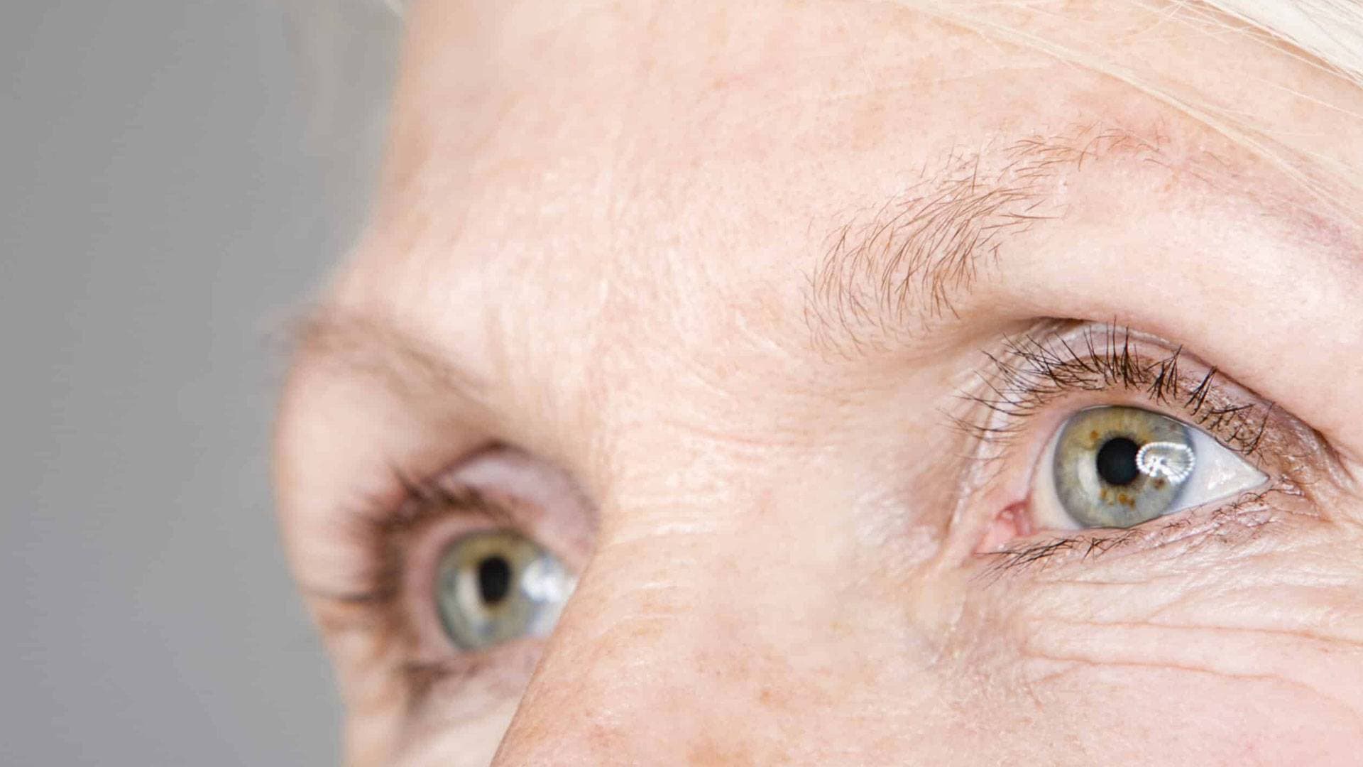 Göz Kapağı Estetiği Blepharoplasty İle Yenilenen Bakışlar